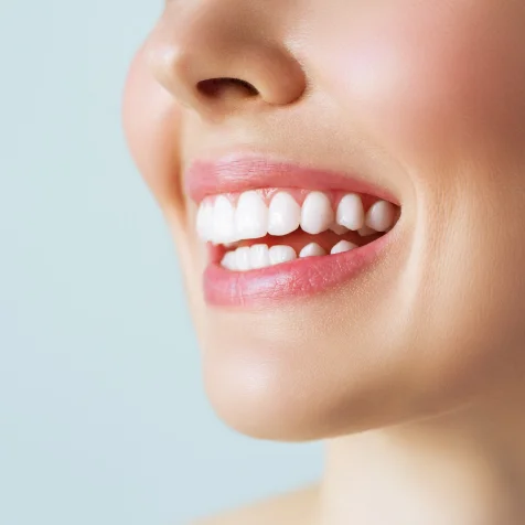 Smile Design - Wedding Smile Case Study
